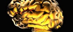 neurologia-xxxx-1357333983